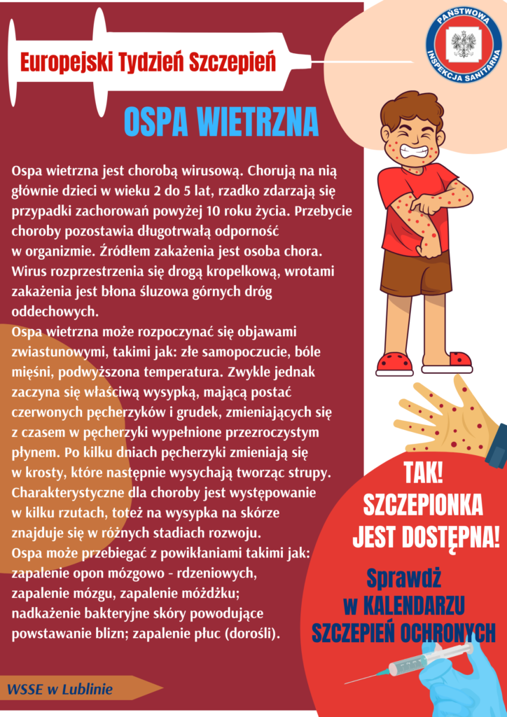 Ospa Wietrzna Ets